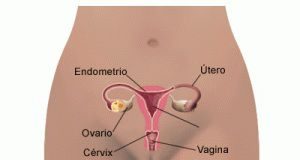 cancercuellouterino