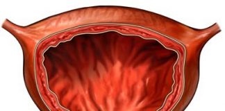 Descubrimiento de nuevos factores genéticos que provocan cáncer de vejiga urinaria la-vejiga