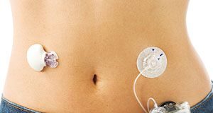 pancreas_artificial1