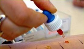 Homeopatía en alergias cutáneas alergias-2