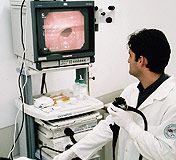 endoscopia_sirio1