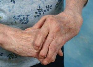 tratamiento_artritis_reumatoide_011