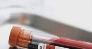 analisis_sangre_fiv2