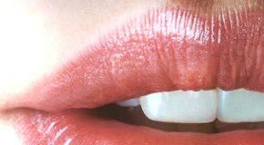labios-sanos1