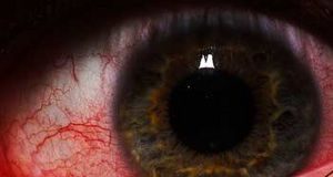 297-oeil-rouge-s