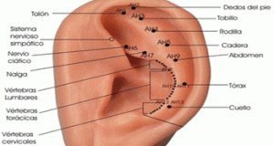 Que-es-la-auriculoterapia