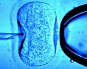 La fecundación in vitro se comparte en las redes sociales fiv1