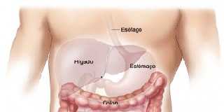 imagencancercolorrectal12