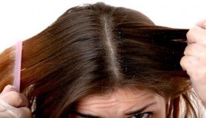 cabello_caspa