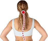 escoliosis1