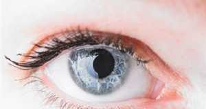 ojos_cataratas1