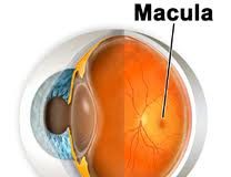 Que-es-la-degeneracion-macular