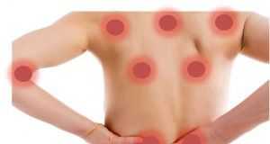 balneario-fibromialgia1