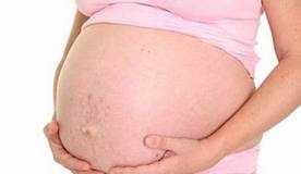 estriasembarazo1