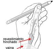 Sufres-tendinitis