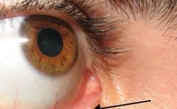 lacrimal