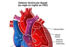 cardippoat