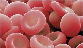 anemias