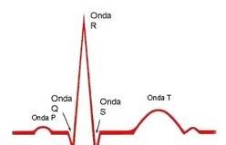 electrocardio