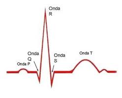 electrocardio