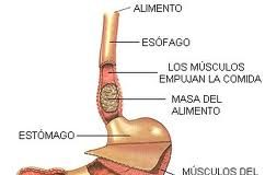 esofagovarices