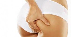 celulitis-2