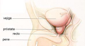 64eac_cancer_prostata1