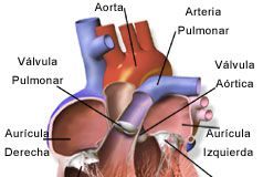 El-Cor-Pulmonale1