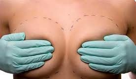 implantemamario