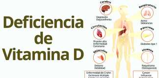 vitamind