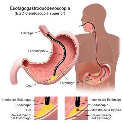 digestivas-hemorragias