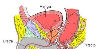 prostata