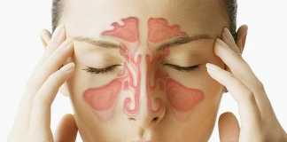 sinusitis12