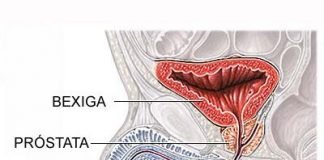 Cancer-de-Prostata