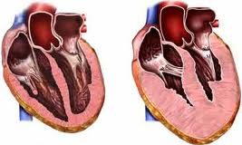 Posible-gen-responsable-de-cardiomiopatia
