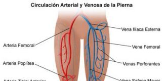 Sintomas-de-la-enfermedad-arterial-periferica