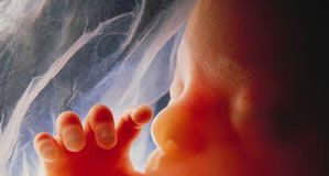 Sufrimiento-fetal-agudo