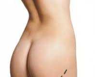 Gluteoplastia