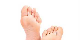 pies-ampollas