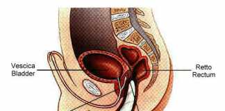 prostata1