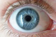glaucoma