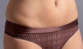 infecciones-micologicas-mujeres