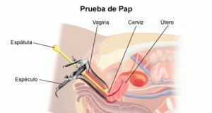 citologia-vaginal