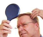 genes-ligados-a-la-perdida-del-cabello