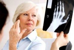 Ansiedad y depresión suelen ir de la mano con la artritis ansiedad-artritis
