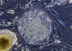 Células de la piel se convirtieron en células cerebrales en un estudio de laboratorio celulaspiel