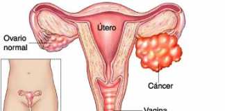ovario