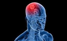 Avances-para-el-tratamiento-de-tumores-cerebrales