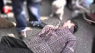 Crisis crónica y repetida como síntoma de una epilepsia generalizada Crisis-cronica-y-repetida-como-sintoma-de-una-epilepsia-generalizada