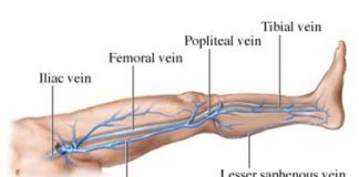 La-gravedad-en-una-arteritis-de-las-extremidades-inferiores